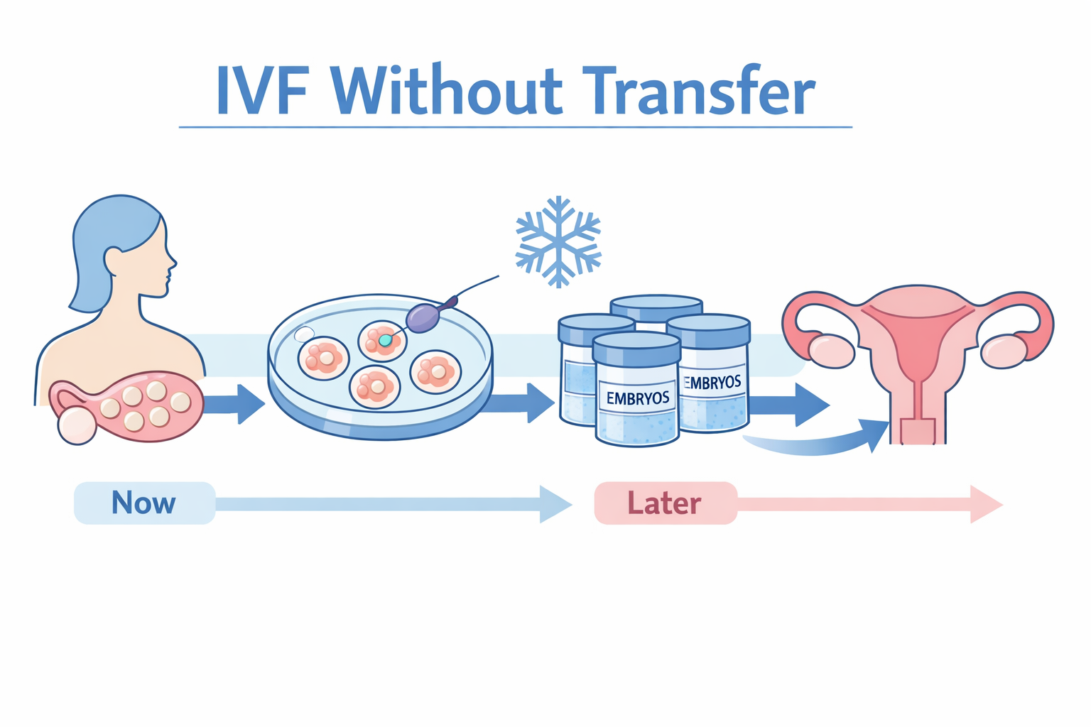IVF Without Transfer. Embryo Freezing Explained